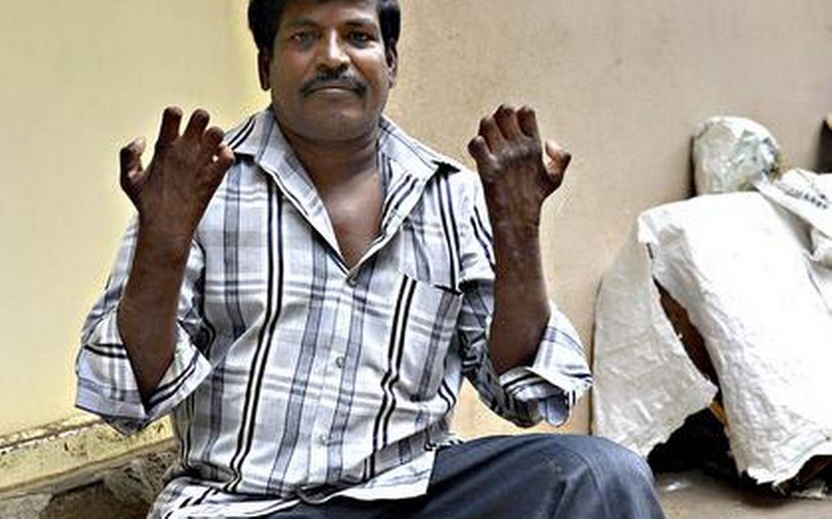 Manual Scavengers drink alcohol to cope.